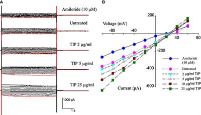 Direct endothelial ENaC activation mitigates vasculopathy induced by SARS-CoV2 spike protein